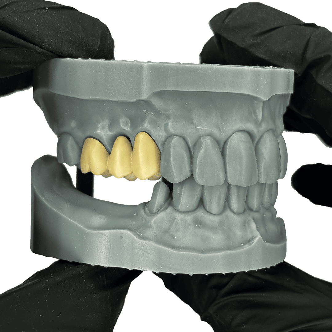Aidite Dental Model Grey résine 3D grise modèle dentaire