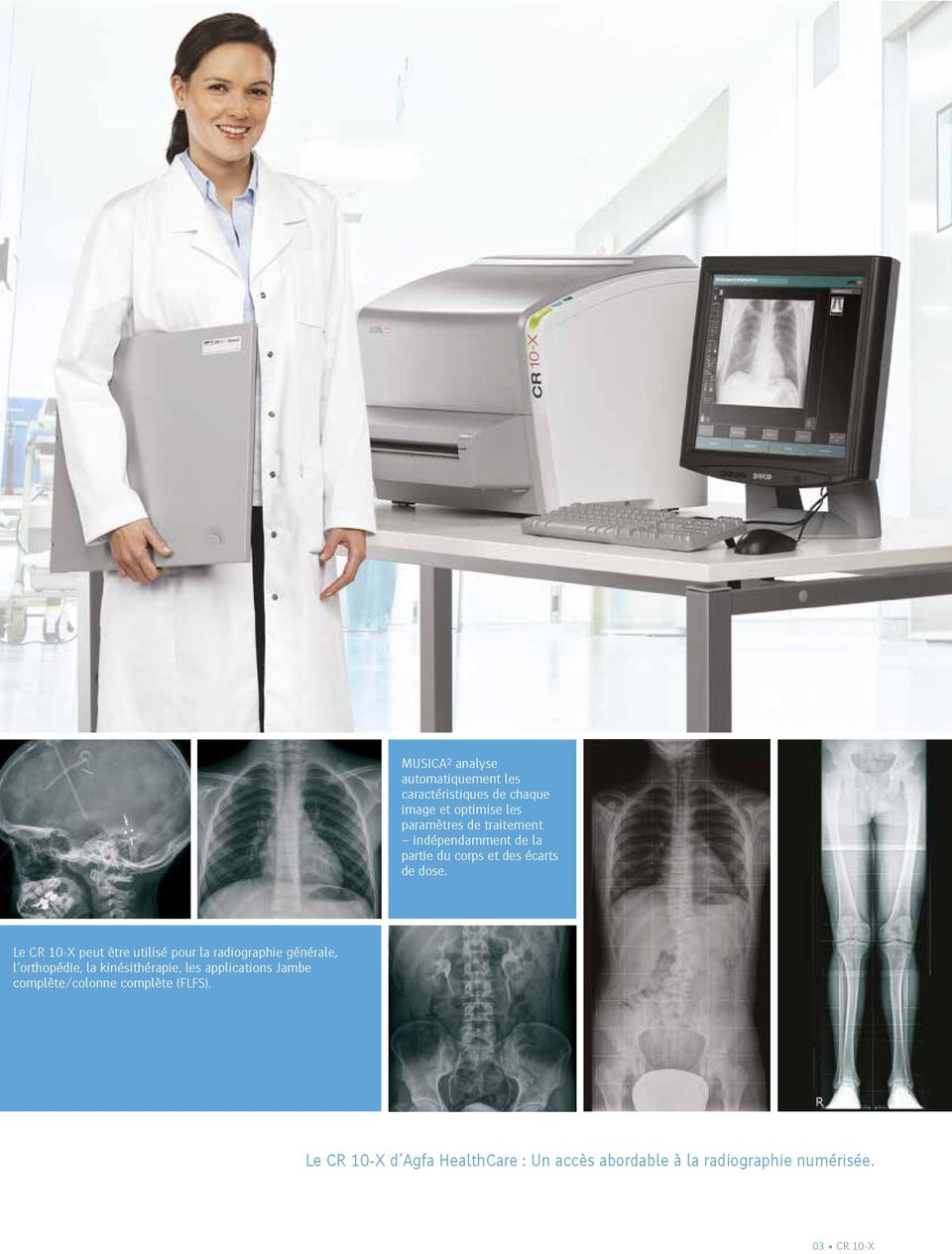 AGFA CR 10-X numériseur radiologie table 100 µm