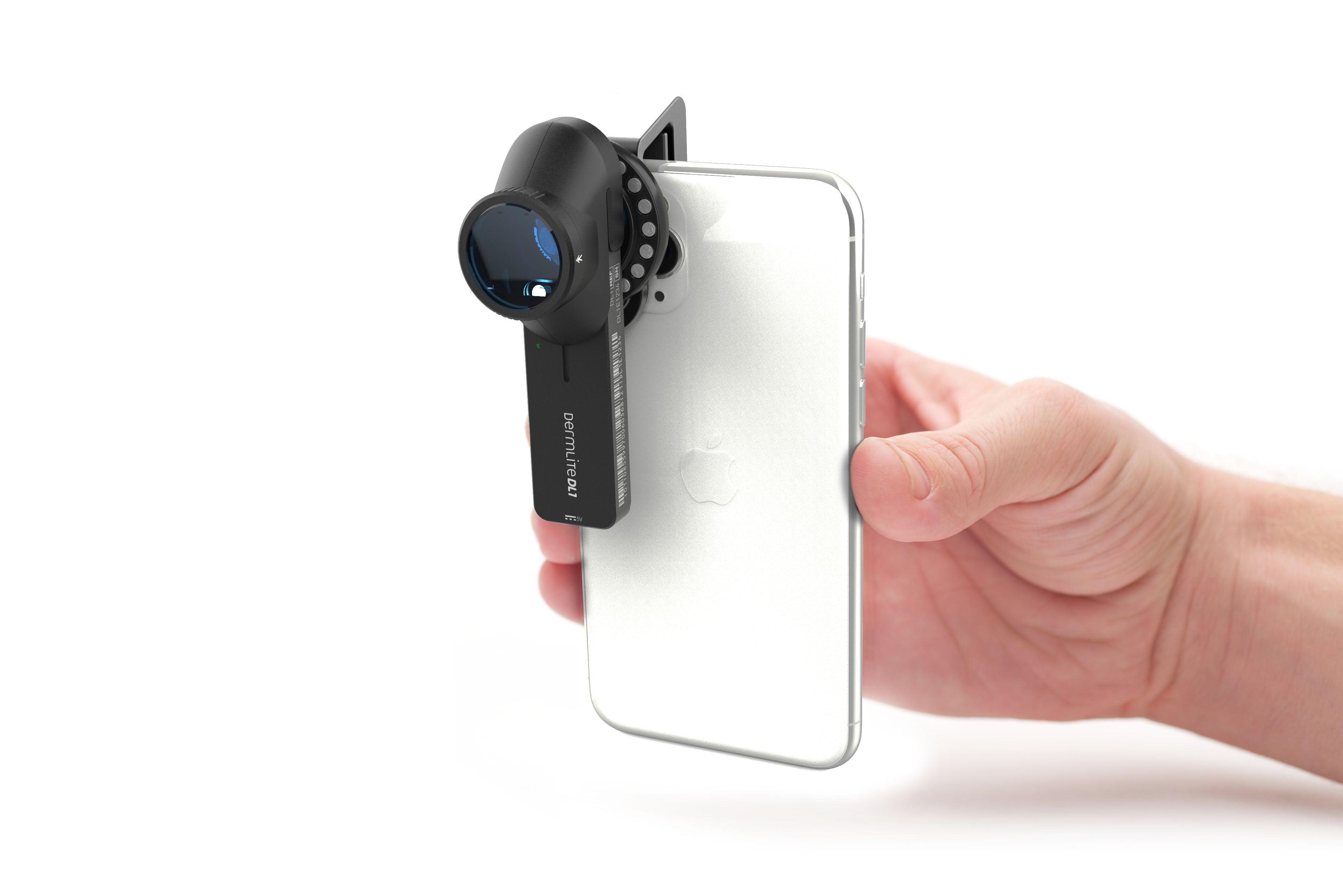 DermLite DL1 basic dermoscope smartphone suivi cutané