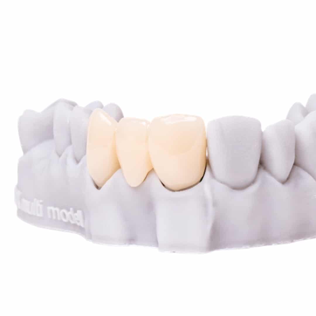 Detax Freeprint Dx Crown résine 3D couronne permanente