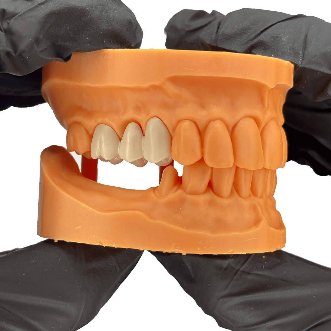 Aidite Dental Model résine 3D dentaire Yellow implant