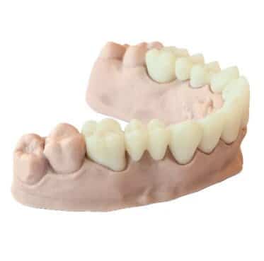 DentaFab PowerResins C-Temp résine 3D dentaire 1kg provisoire