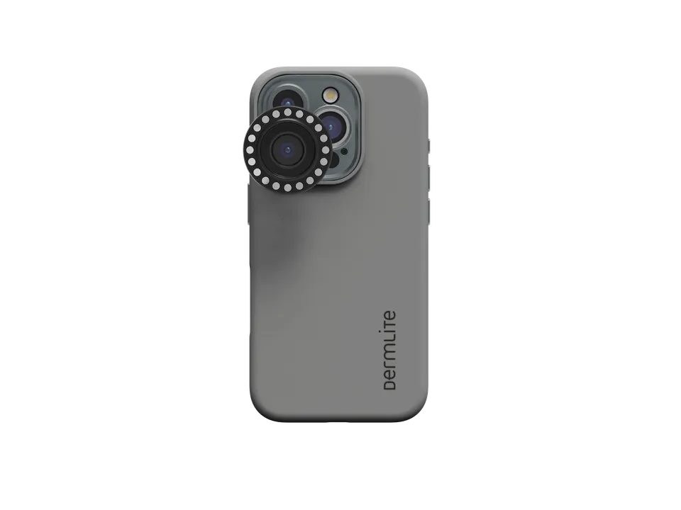 DermLite DL Connection Kit adaptateur iPhone 17 dermatoscope