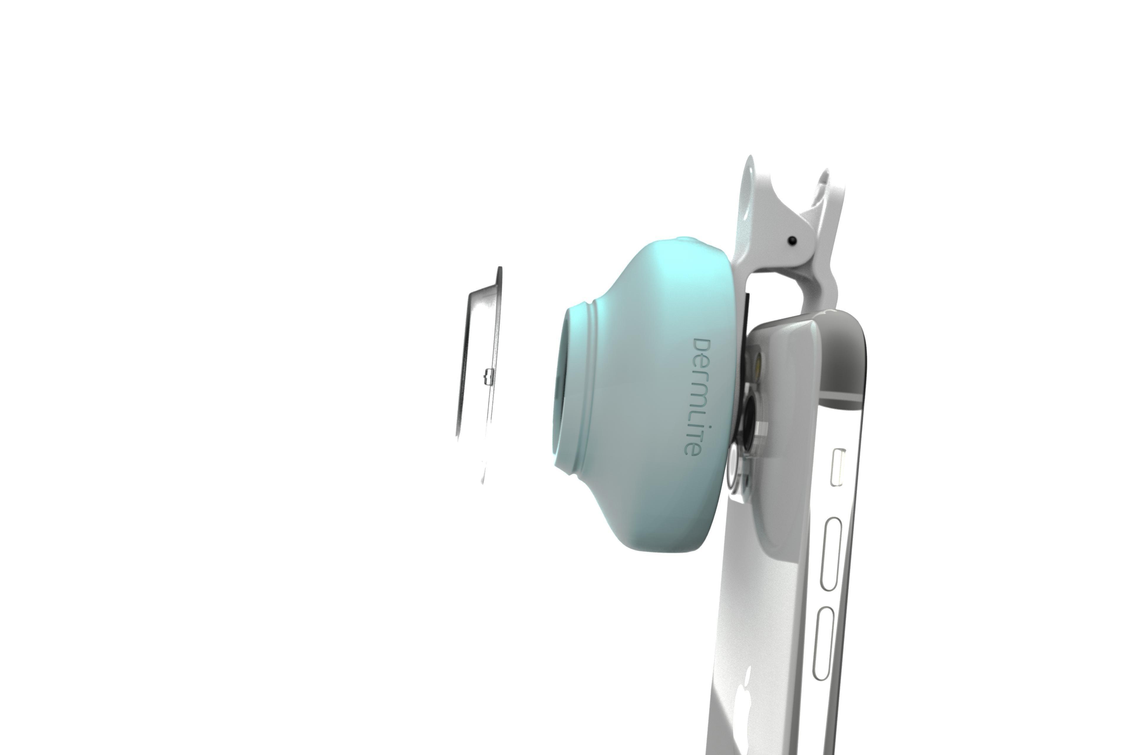 DermLite HÜD 2 dermoscope smartphone suivi domicile