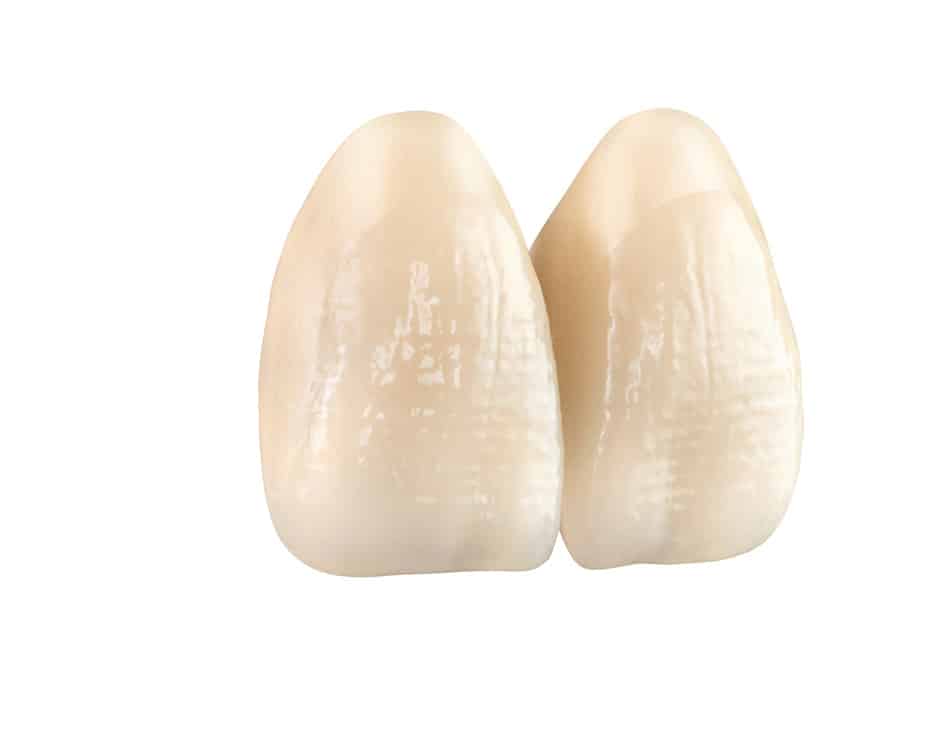 Vita Vionic Vigo Posterior dents prothétiques postérieures numériques