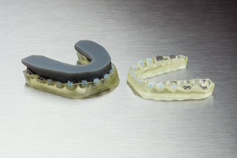 Formlabs IBT résine dentaire 1L gouttière collage indirect