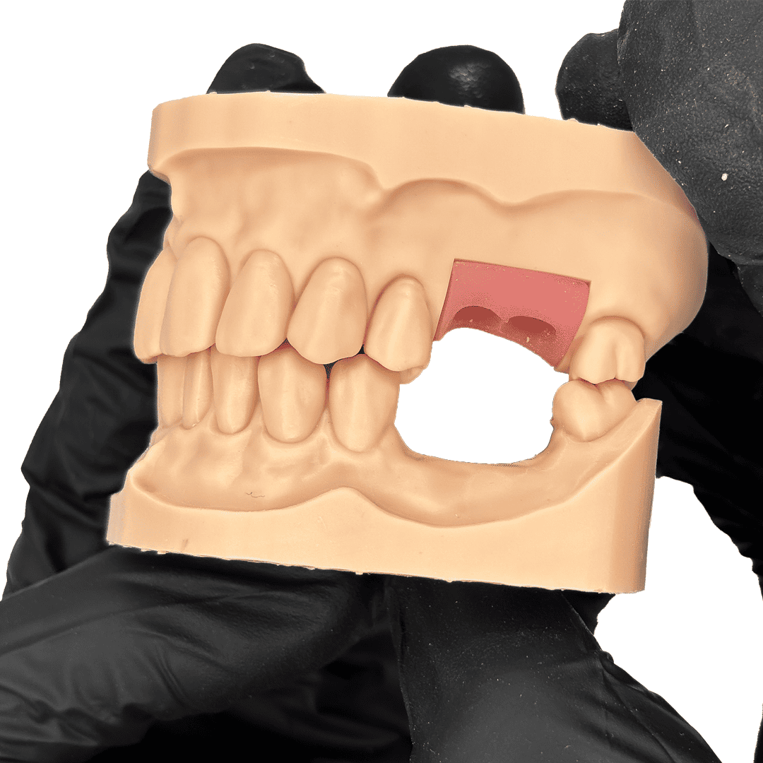 Aidite Dental Model résine 3D dentaire Almond modèle implantaire