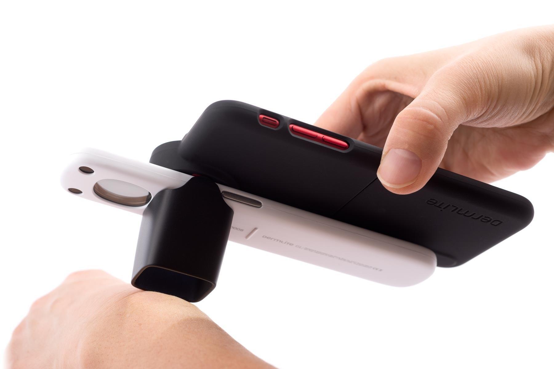DermLite GL dermatoscope poche smartphone double lentille 6x