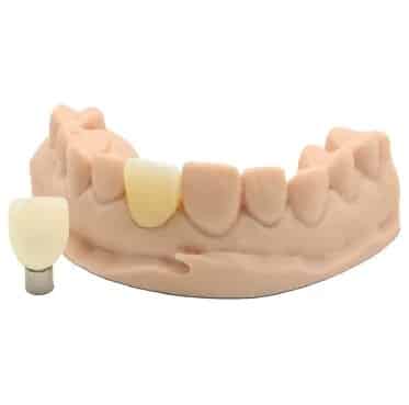 DentaFab PowerResins C-Temp résine 3D dentaire 1kg provisoire