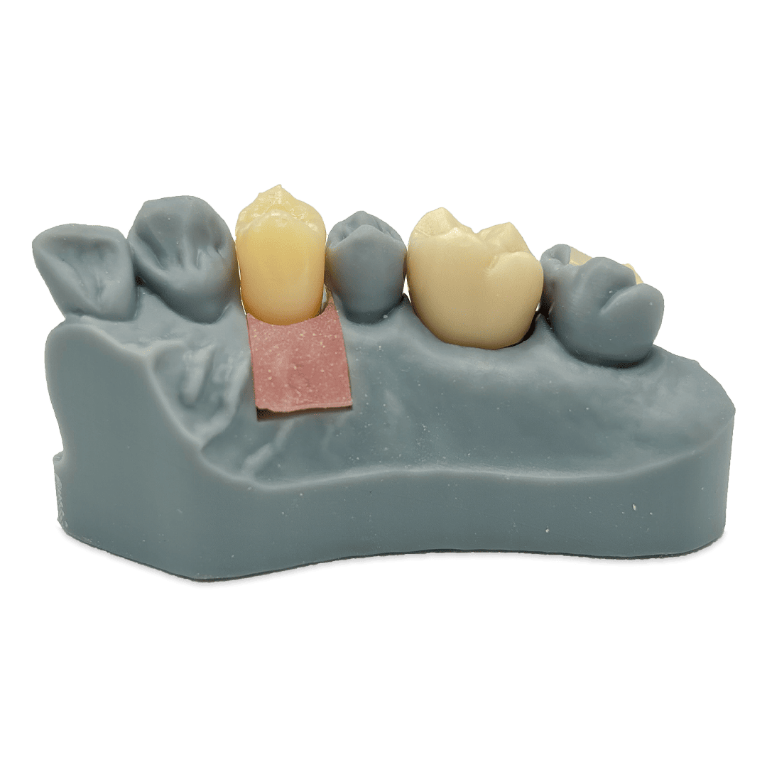 Aidite Dental Model Grey résine 3D grise modèle dentaire