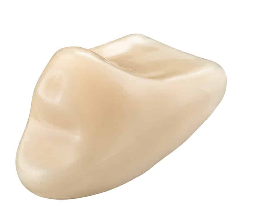 Vita Vionic Vigo Posterior dents prothétiques postérieures numériques