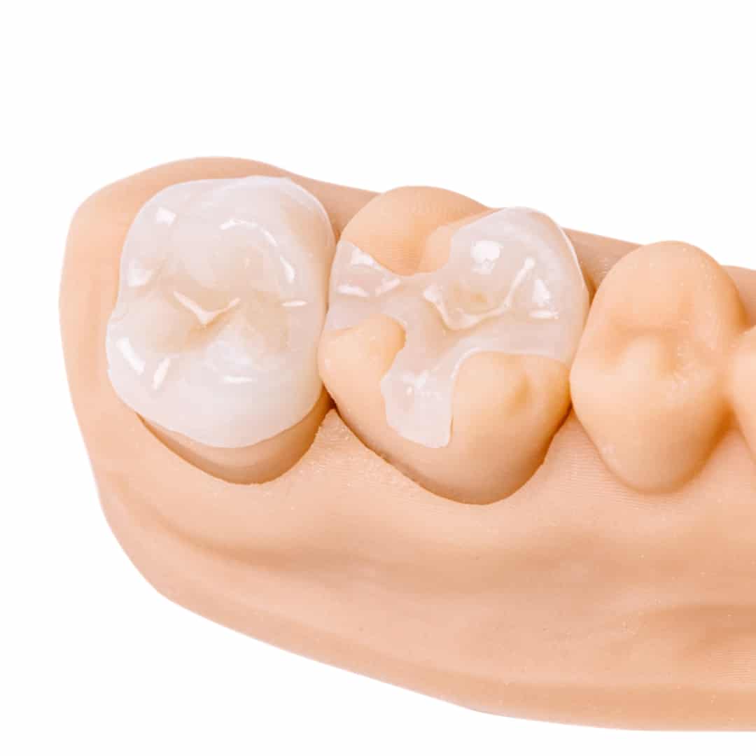 Detax Freeprint Dx Crown résine 3D couronne permanente