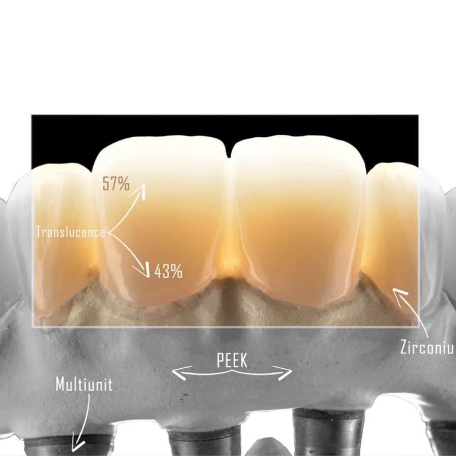 Aidite 3D Pro Zir disque zircone 95mm Zirkonzahn multicouche