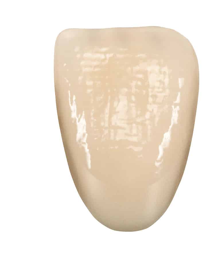 Vita Vionic Vigo Posterior dents prothétiques postérieures numériques