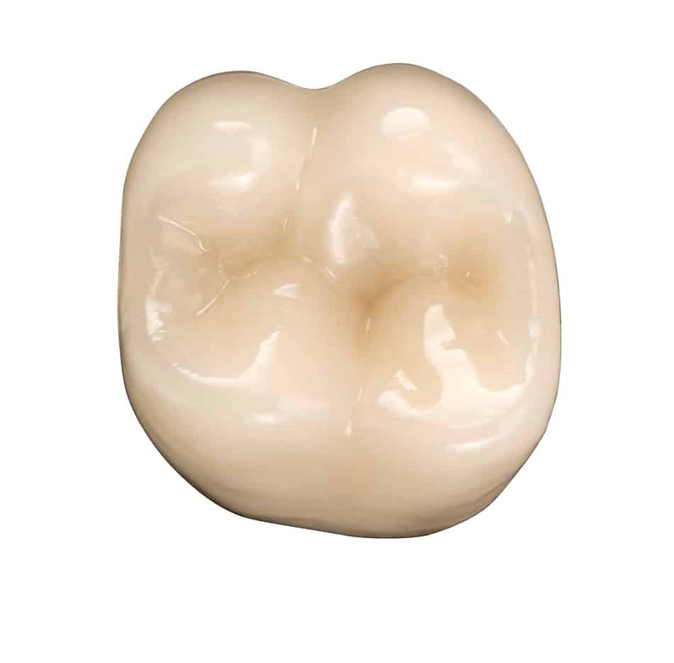 Vita Vionic Vigo Posterior dents prothétiques postérieures numériques