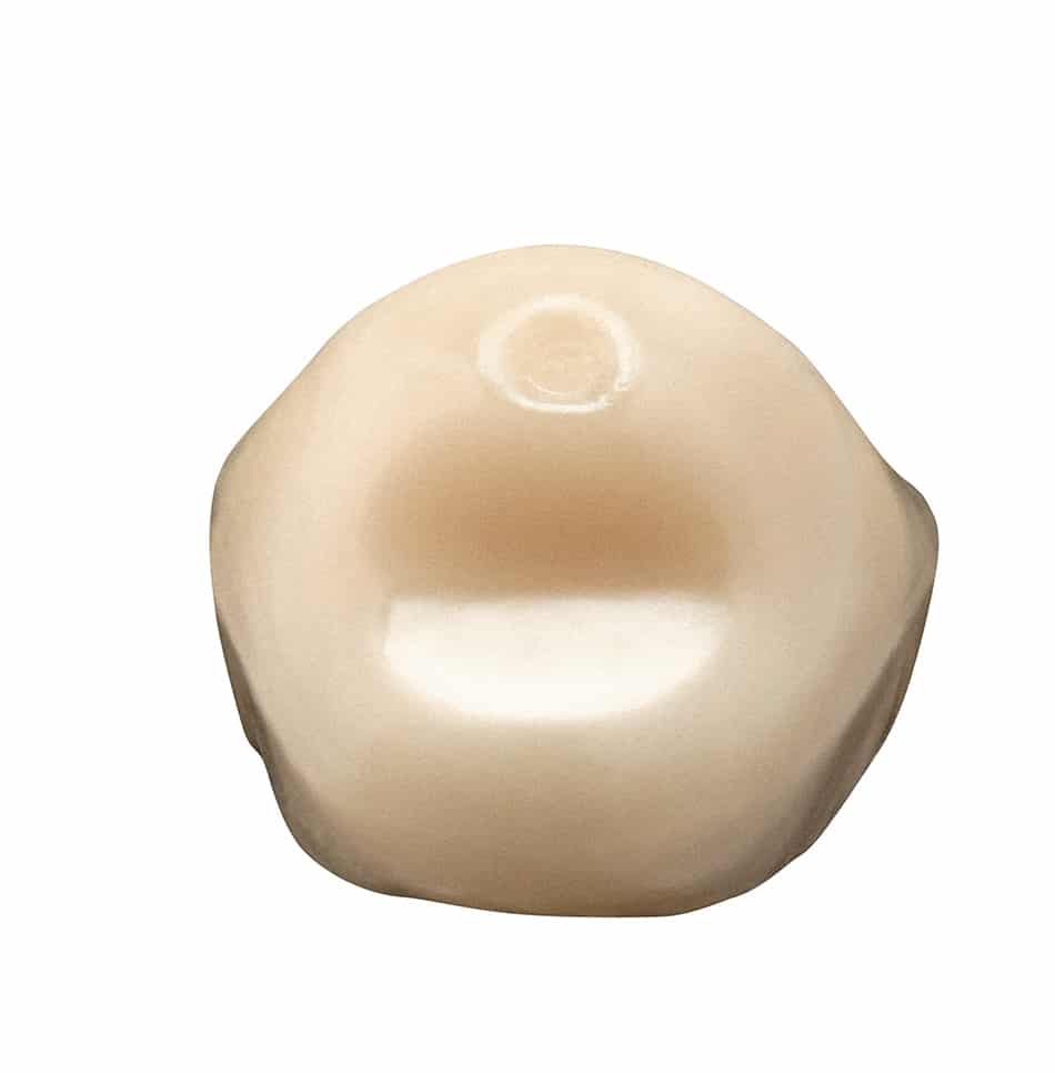 Vita Vionic Vigo Posterior dents prothétiques postérieures numériques