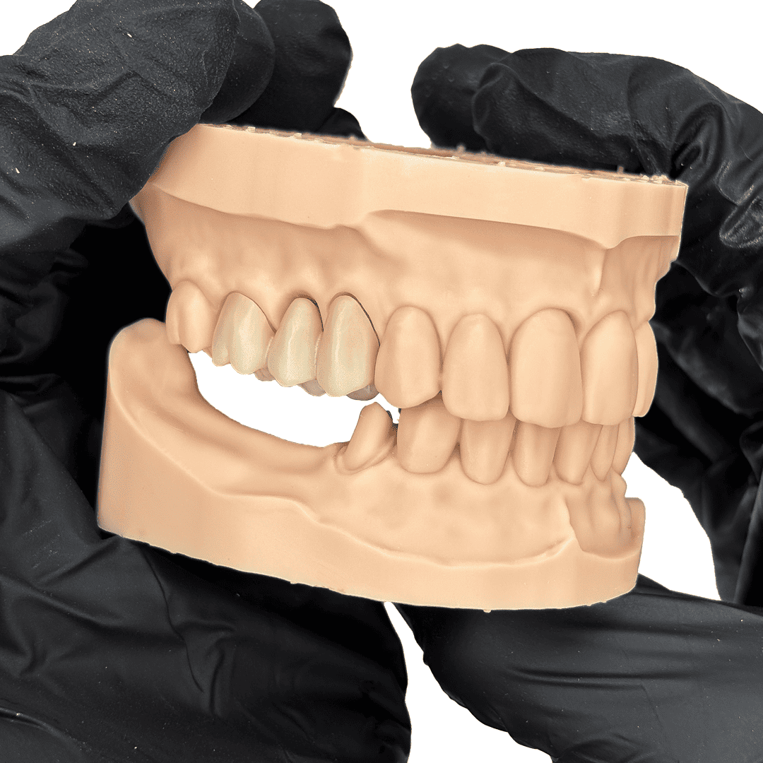 Aidite Dental Model résine 3D dentaire Almond modèle implantaire
