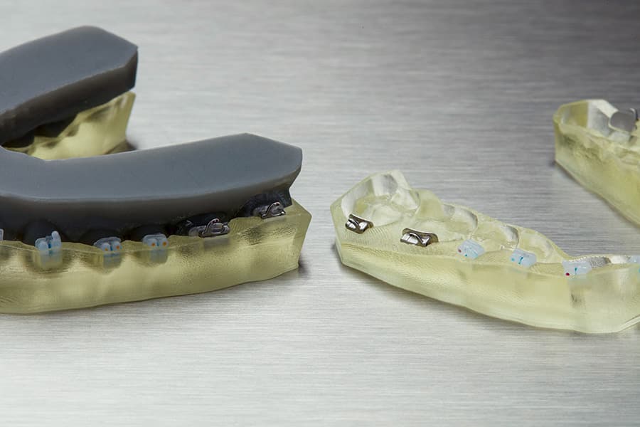 Formlabs IBT résine dentaire 1L gouttière collage indirect