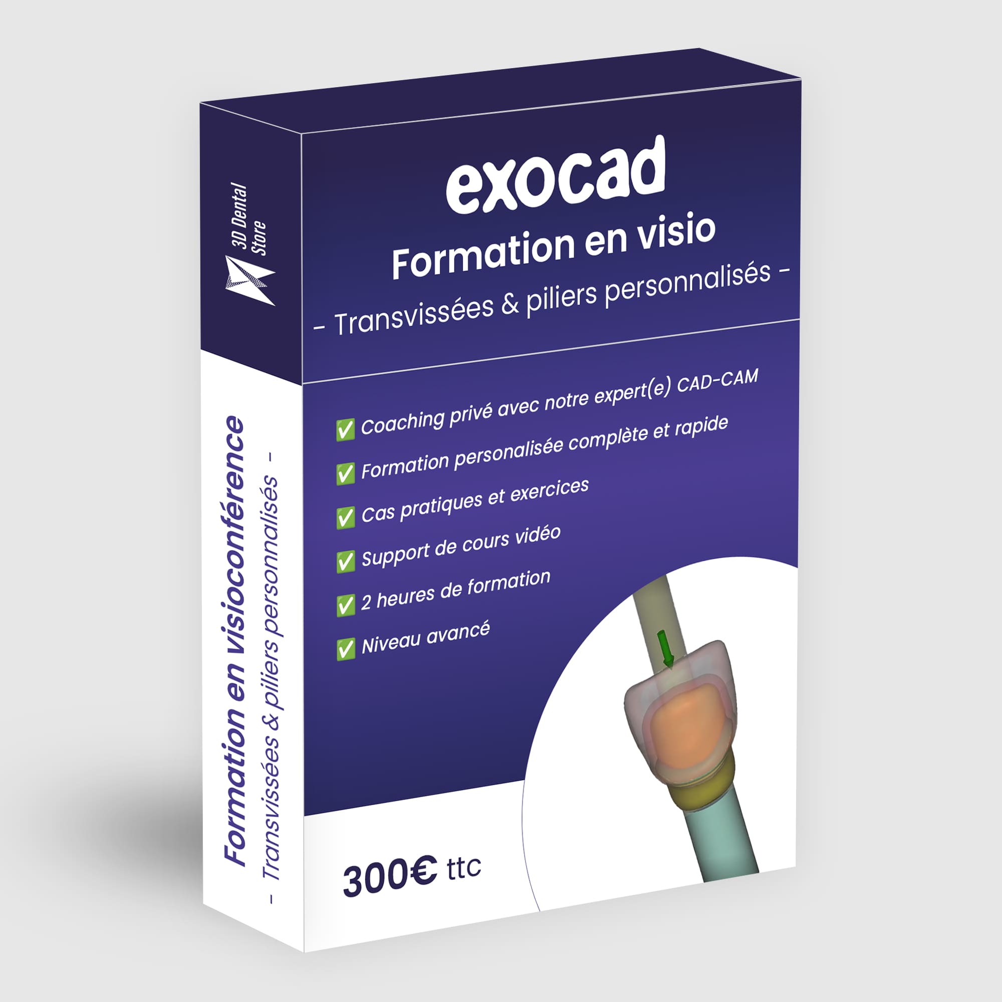 Exocad formation transvissée pilier personnalisé 2h visio