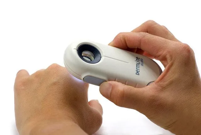 DermLite DL100 dermatoscope polarisé de poche 10x LED