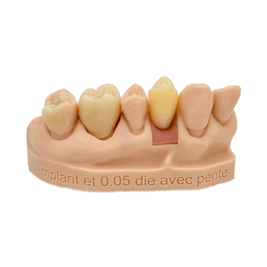 Aidite Dental Model résine 3D dentaire Almond modèle implantaire