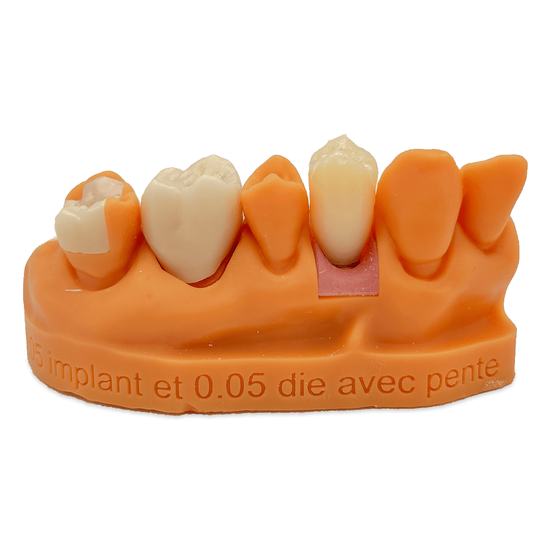 Aidite Dental Model résine 3D dentaire Yellow implant