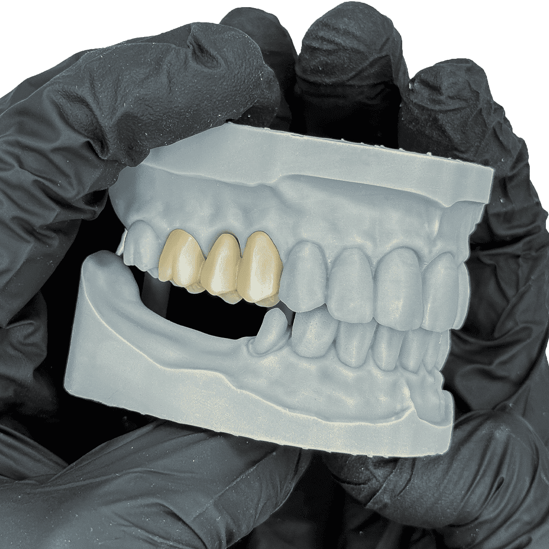 Liqcreate Dental Model Pro résine 3D grise modèle précision