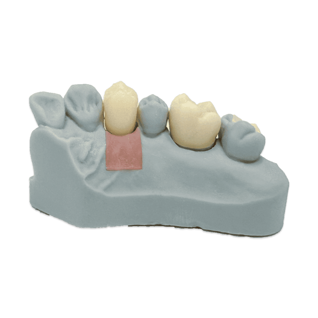 Liqcreate Dental Model Pro résine 3D grise modèle précision