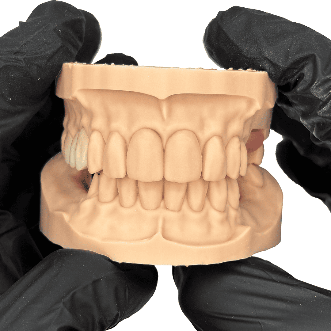 Aidite Dental Model résine 3D dentaire Almond modèle implantaire