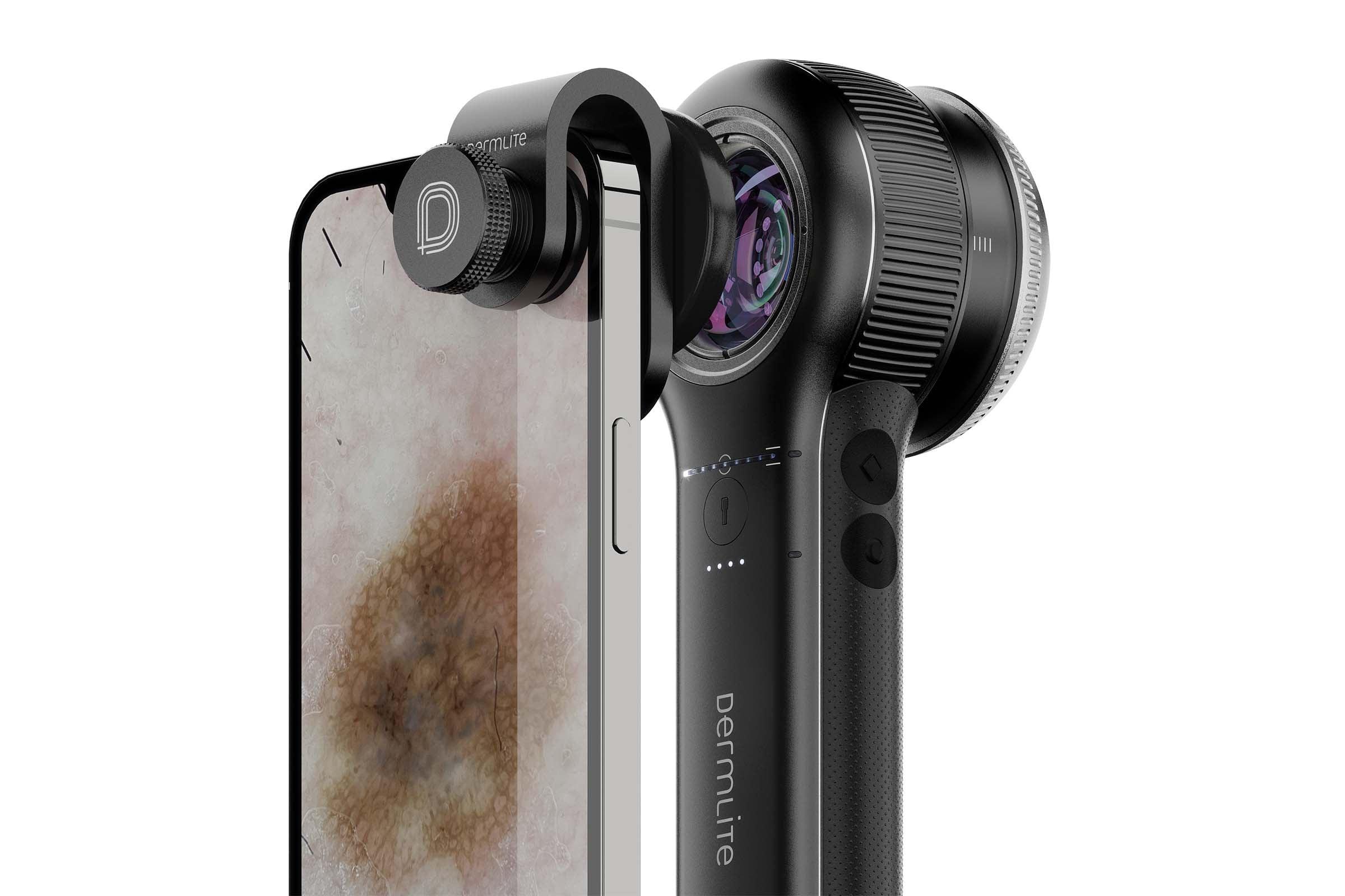 DermLite DL5 dermatoscope polarisé 10x UV smartphone