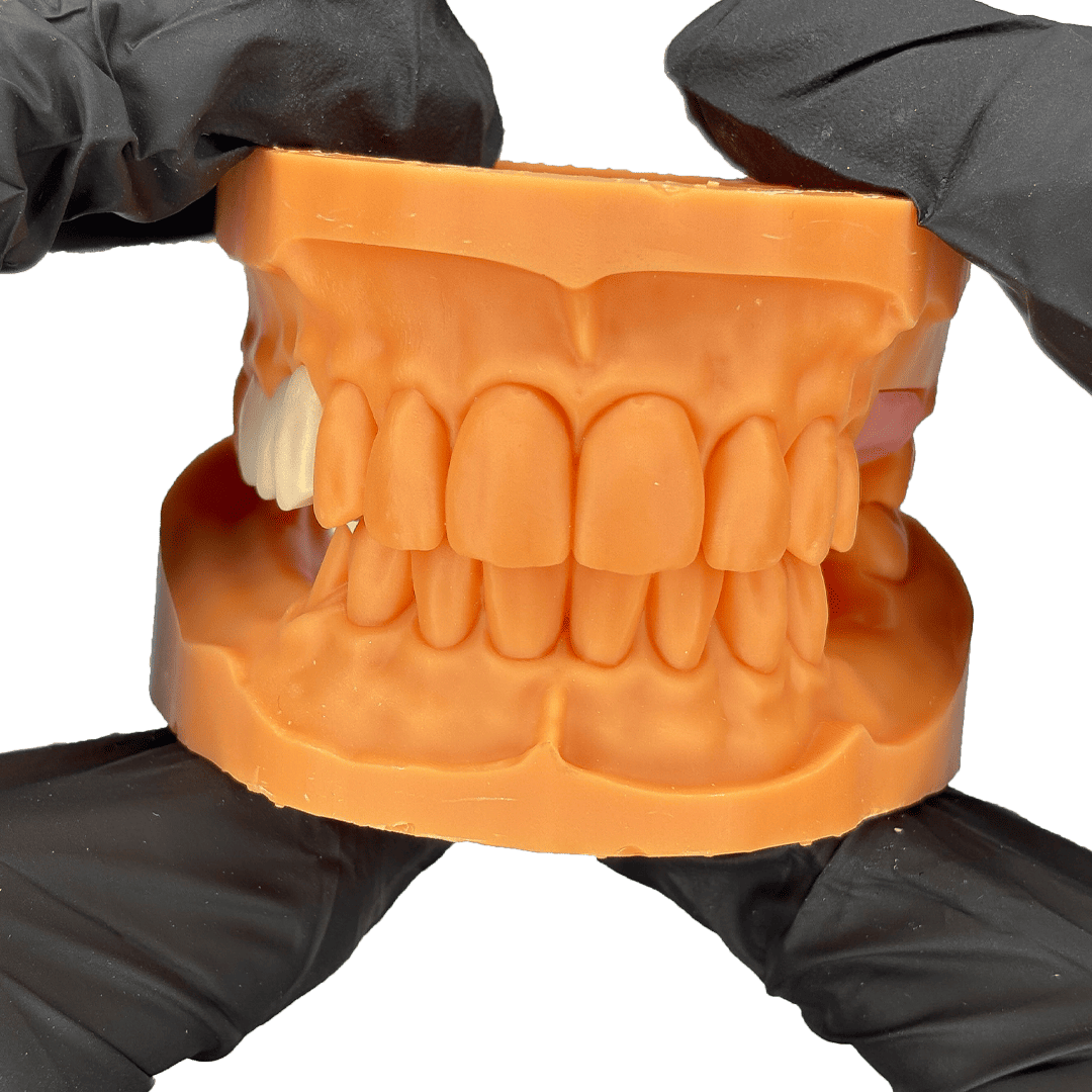 Aidite Dental Model résine 3D dentaire Yellow implant