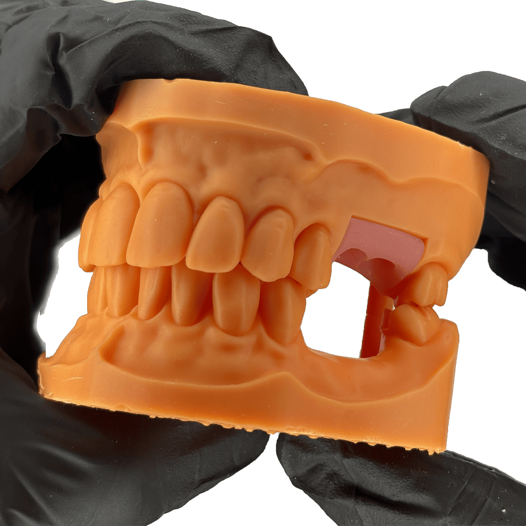 Aidite Dental Model résine 3D dentaire Yellow implant