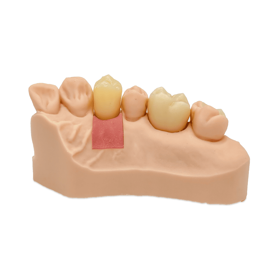 Aidite Dental Model résine 3D dentaire Almond modèle implantaire