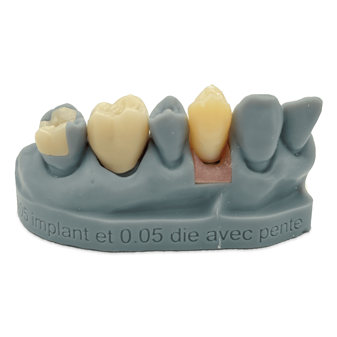 Aidite Dental Model Grey résine 3D grise modèle dentaire